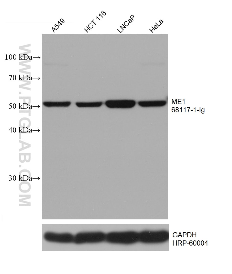 Western Blot (WB) analysis of various lysates using ME1 Monoclonal antibody (68117-1-Ig)