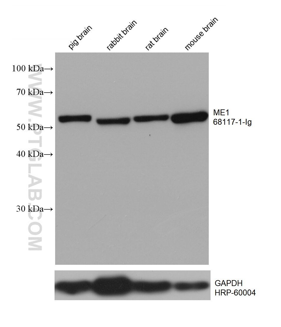 Western Blot (WB) analysis of various lysates using ME1 Monoclonal antibody (68117-1-Ig)