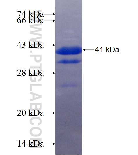ME1 fusion protein Ag9916 SDS-PAGE