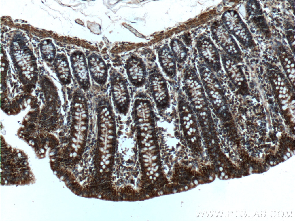 IHC staining of human colon using 24944-1-AP