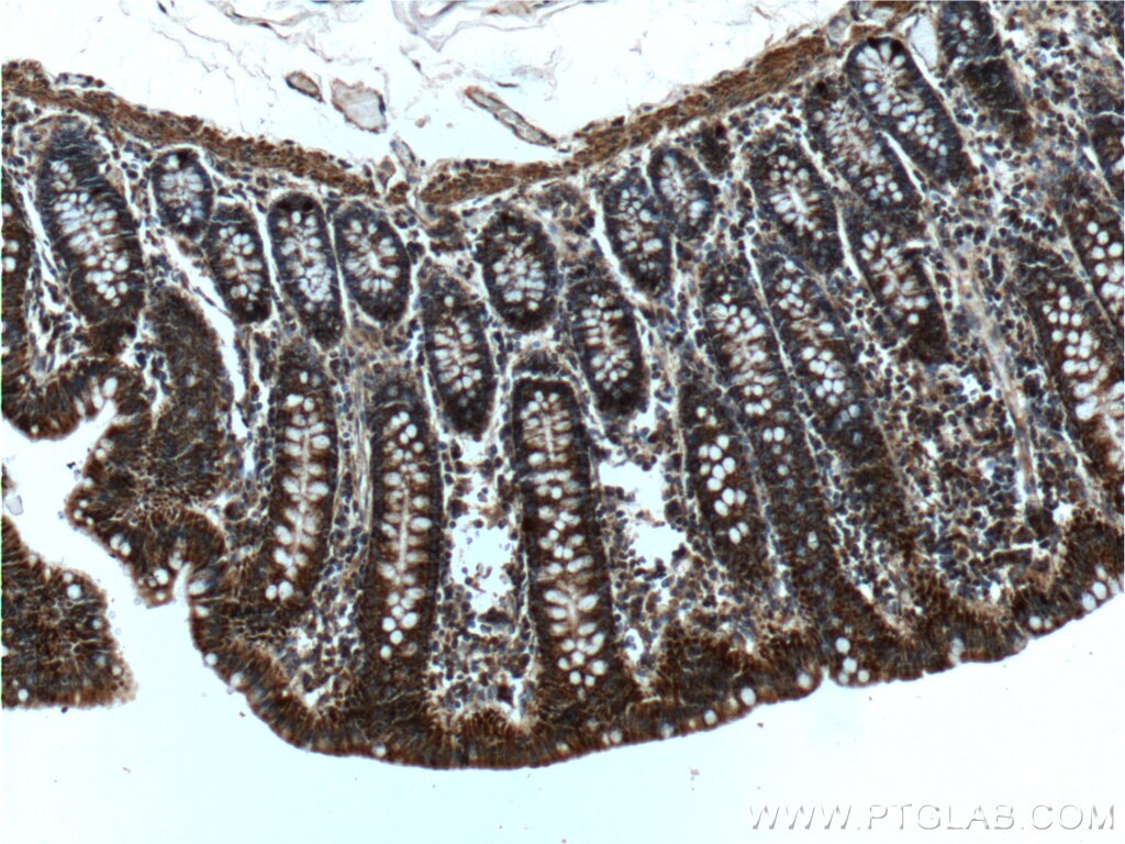 Immunohistochemistry (IHC) staining of human colon tissue using ME2 Polyclonal antibody (24944-1-AP)