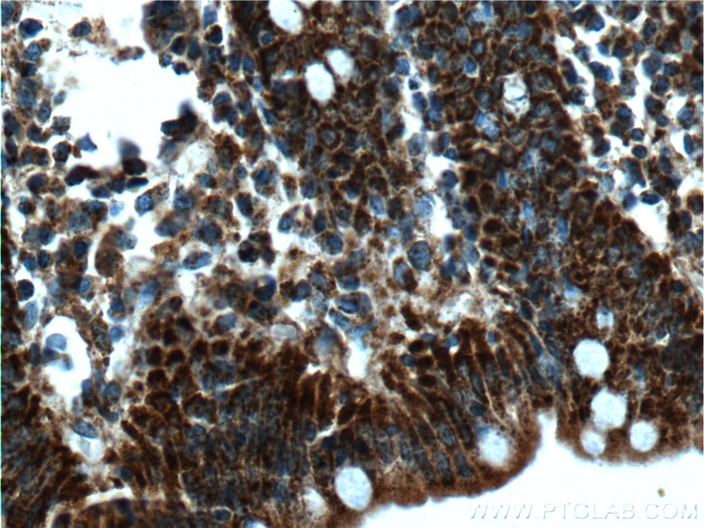 Immunohistochemistry (IHC) staining of human colon tissue using ME2 Polyclonal antibody (24944-1-AP)