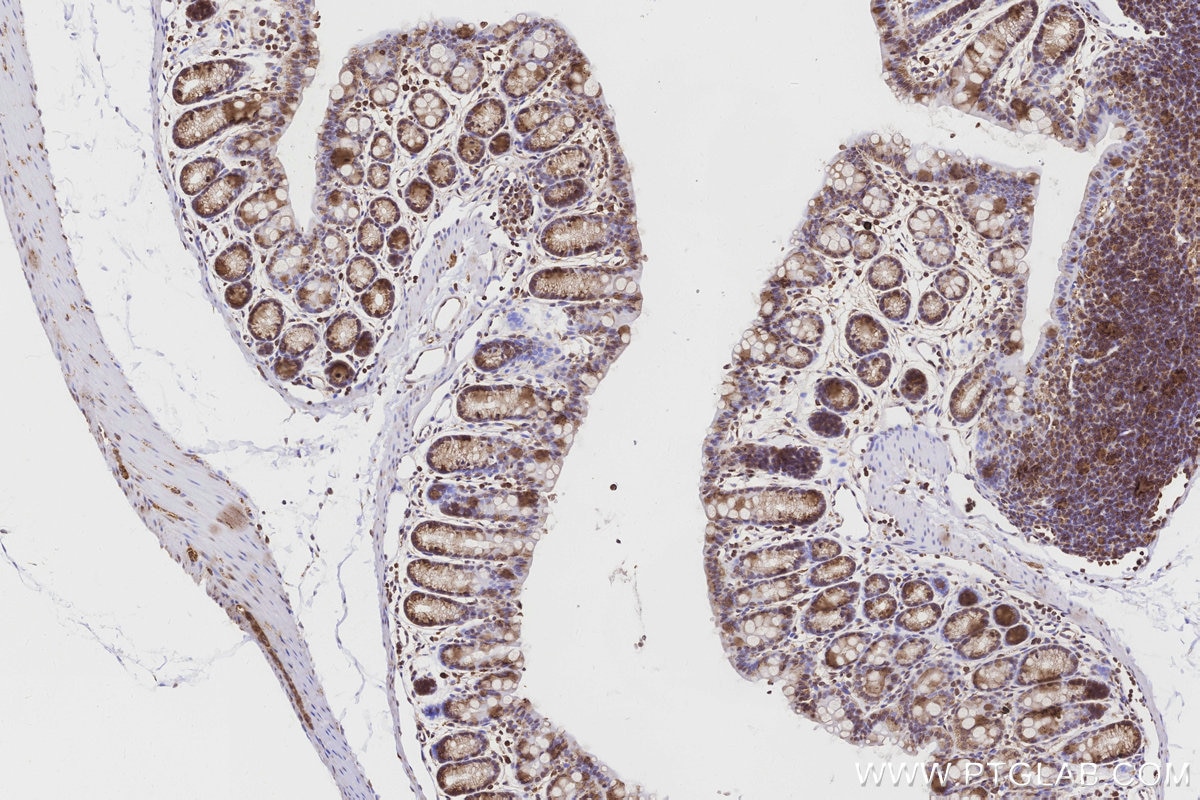 Immunohistochemistry (IHC) staining of mouse colon tissue using ME2 Polyclonal antibody (24944-1-AP)