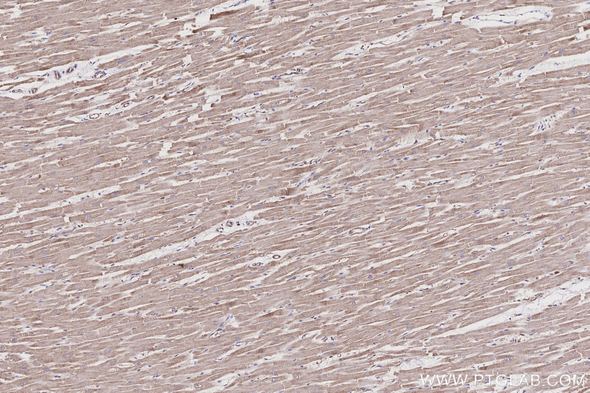 Immunohistochemistry (IHC) staining of human heart tissue using ME2 Polyclonal antibody (24944-1-AP)