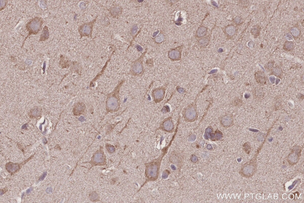 Immunohistochemistry (IHC) staining of rat brain tissue using ME2 Polyclonal antibody (24944-1-AP)
