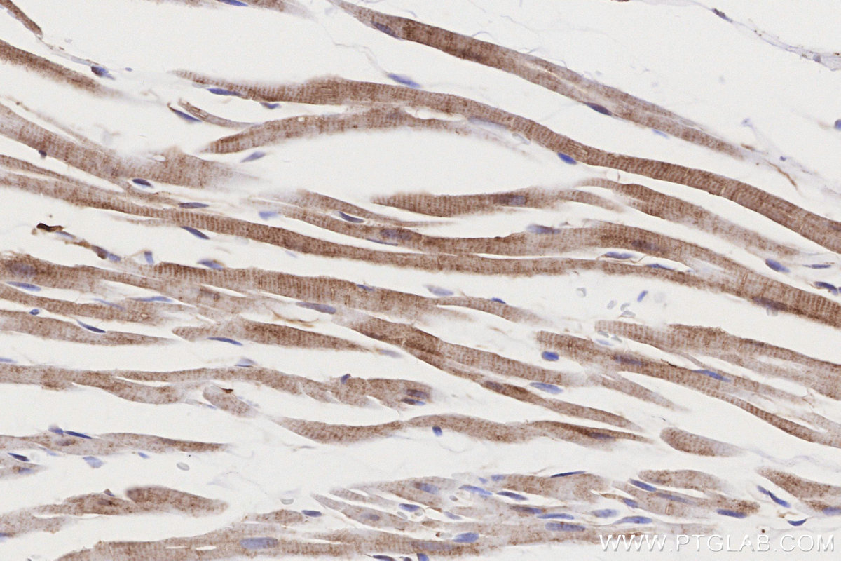Immunohistochemistry (IHC) staining of rat heart tissue using ME2 Polyclonal antibody (24944-1-AP)