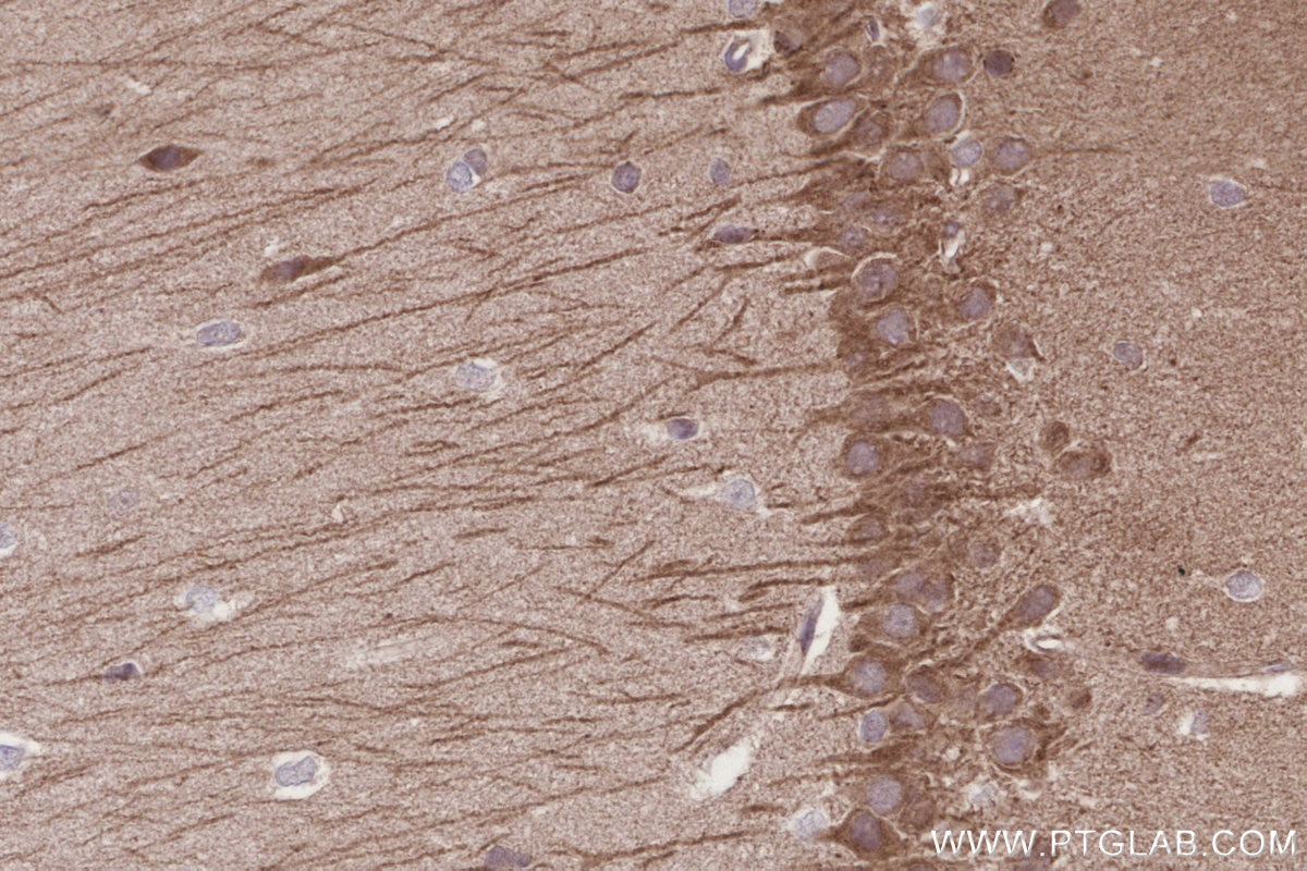 Immunohistochemistry (IHC) staining of rat brain tissue using ME2 Polyclonal antibody (24944-1-AP)