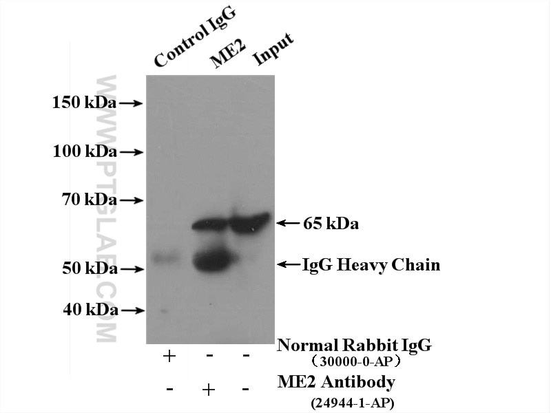 Immunoprecipitation (IP) experiment of HeLa cells using ME2 Polyclonal antibody (24944-1-AP)