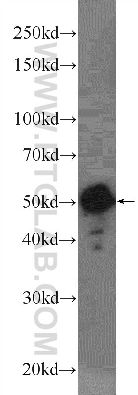 Western Blot (WB) analysis of Jurkat cells using ME2 Polyclonal antibody (24944-1-AP)