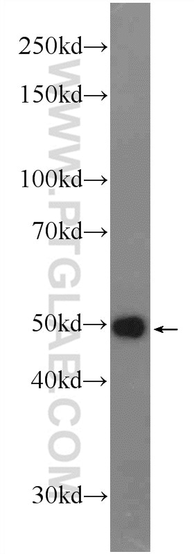 Western Blot (WB) analysis of HL-60 cells using ME2 Polyclonal antibody (24944-1-AP)