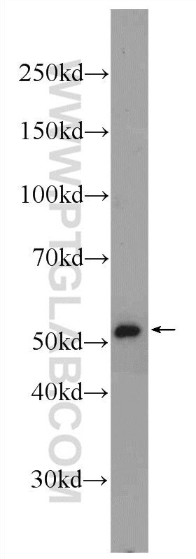 Western Blot (WB) analysis of HeLa cells using ME2 Polyclonal antibody (24944-1-AP)