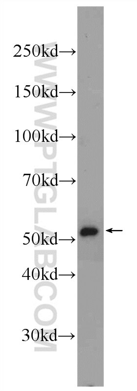 WB analysis of HeLa using 24944-1-AP