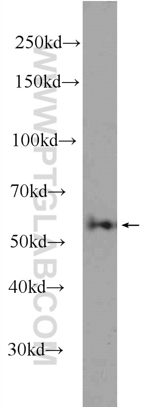 Western Blot (WB) analysis of Jurkat cells using ME2 Polyclonal antibody (24944-1-AP)