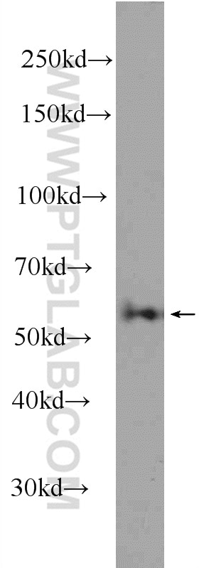 WB analysis of Jurkat using 24944-1-AP