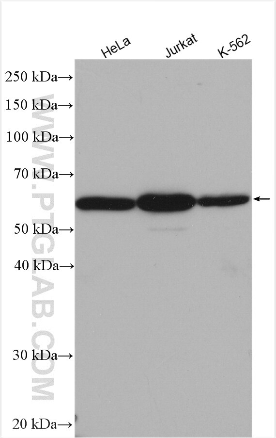 Western Blot (WB) analysis of various lysates using ME2 Polyclonal antibody (24944-1-AP)