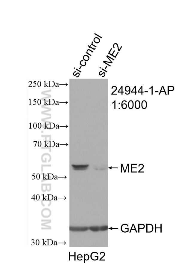 Western Blot (WB) analysis of HepG2 cells using ME2 Polyclonal antibody (24944-1-AP)