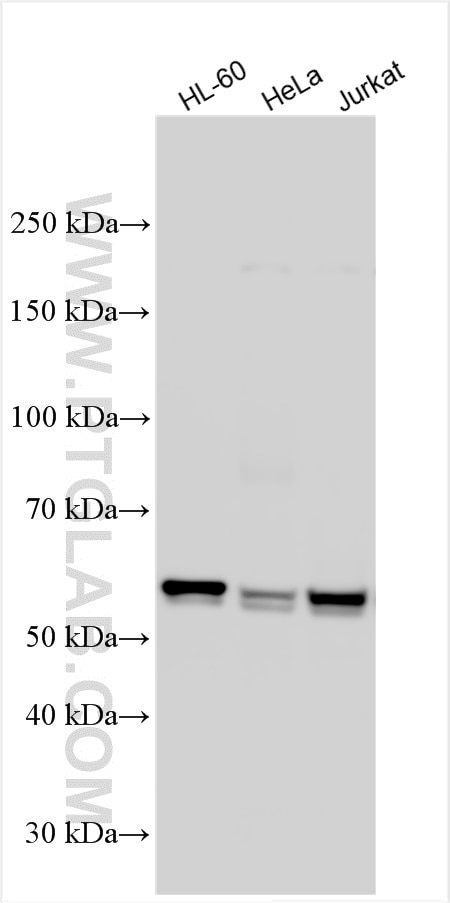 Western Blot (WB) analysis of various lysates using ME2 Polyclonal antibody (24944-1-AP)