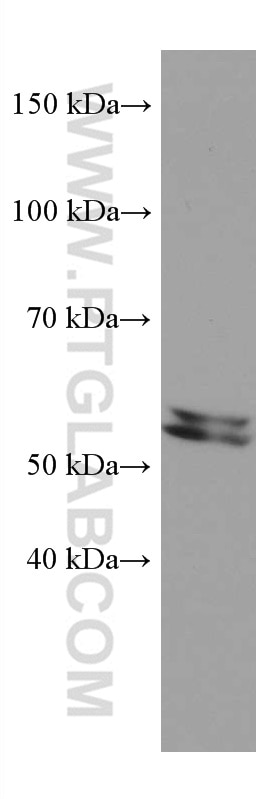 Western Blot (WB) analysis of HeLa cells using ME2 Monoclonal antibody (67457-1-Ig)