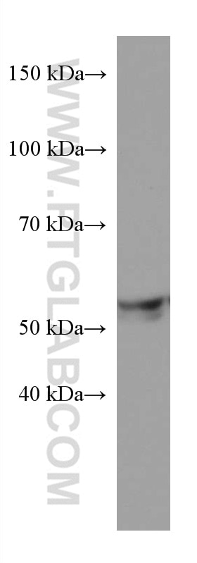 Western Blot (WB) analysis of HepG2 cells using ME2 Monoclonal antibody (67457-1-Ig)