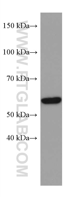 WB analysis of human peripheral blood platelets using 67457-1-Ig