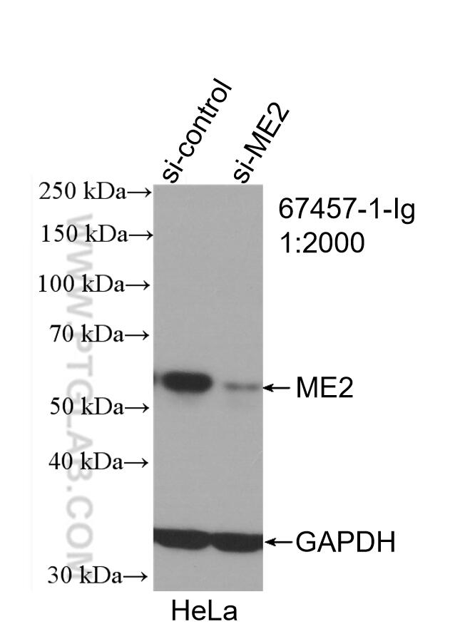 WB analysis of HeLa using 67457-1-Ig