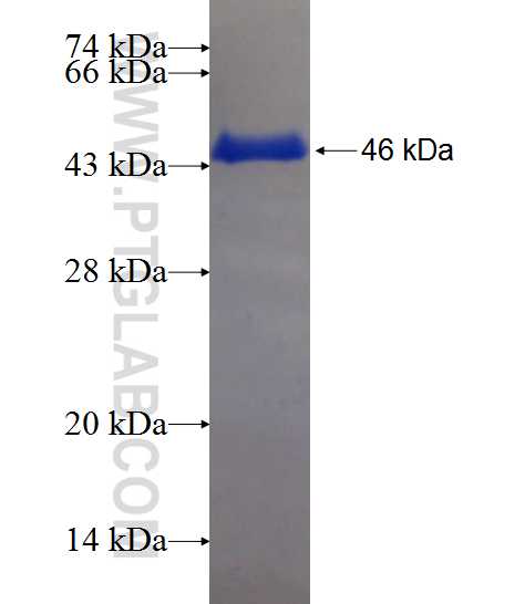 ME2 fusion protein Ag20741 SDS-PAGE