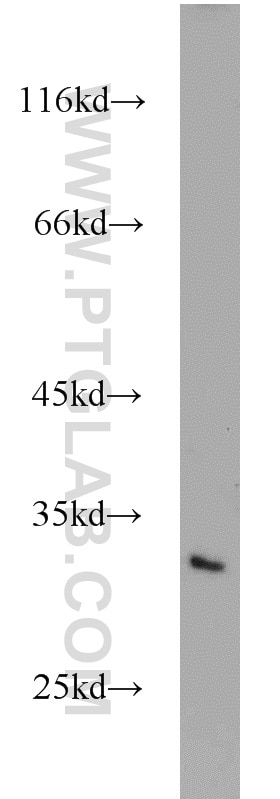 Western Blot (WB) analysis of Jurkat cells using MEA1 Polyclonal antibody (10267-1-AP)