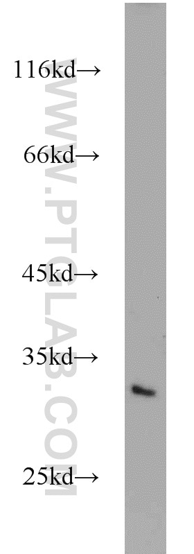 WB analysis of Jurkat using 10267-1-AP