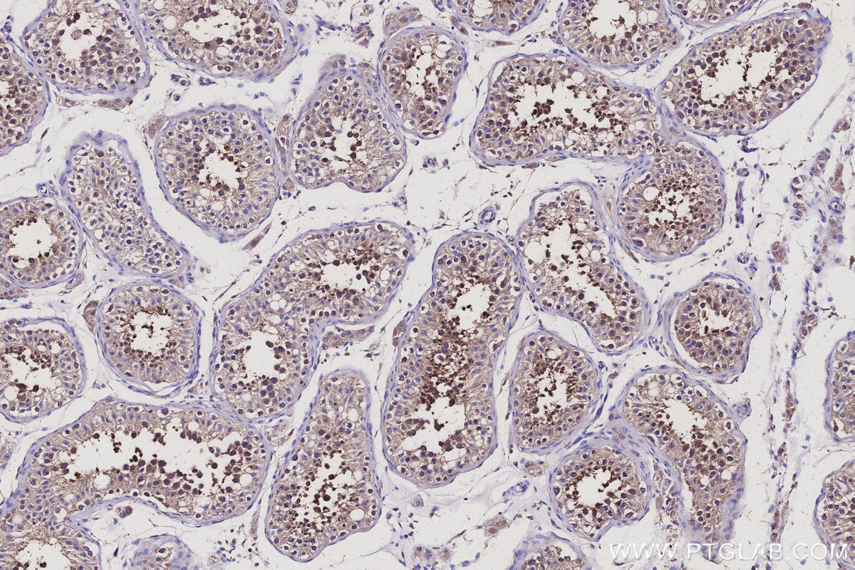 Immunohistochemistry (IHC) staining of human testis tissue using MEA1 Monoclonal antibody (66472-1-Ig)