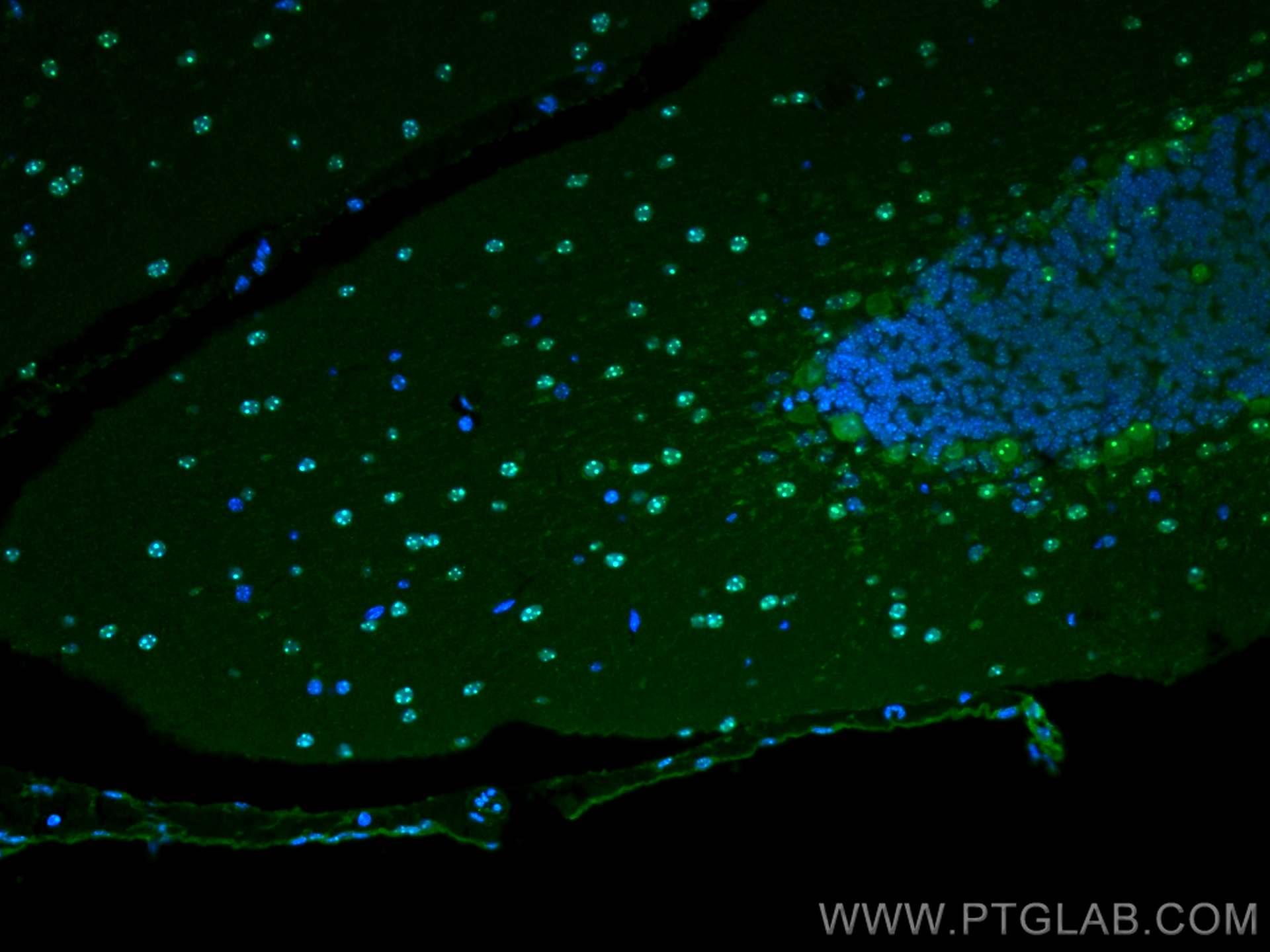 IF Staining of mouse cerebellum using 10861-1-AP