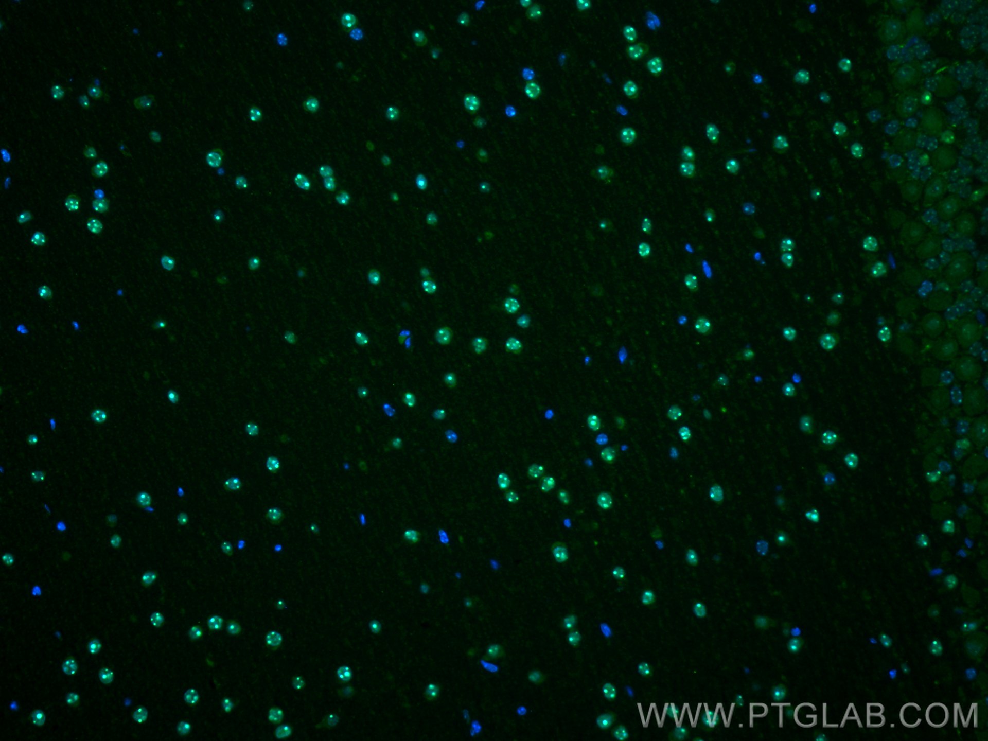 Immunofluorescence (IF) / fluorescent staining of mouse cerebellum tissue using MECP2 Polyclonal antibody (10861-1-AP)