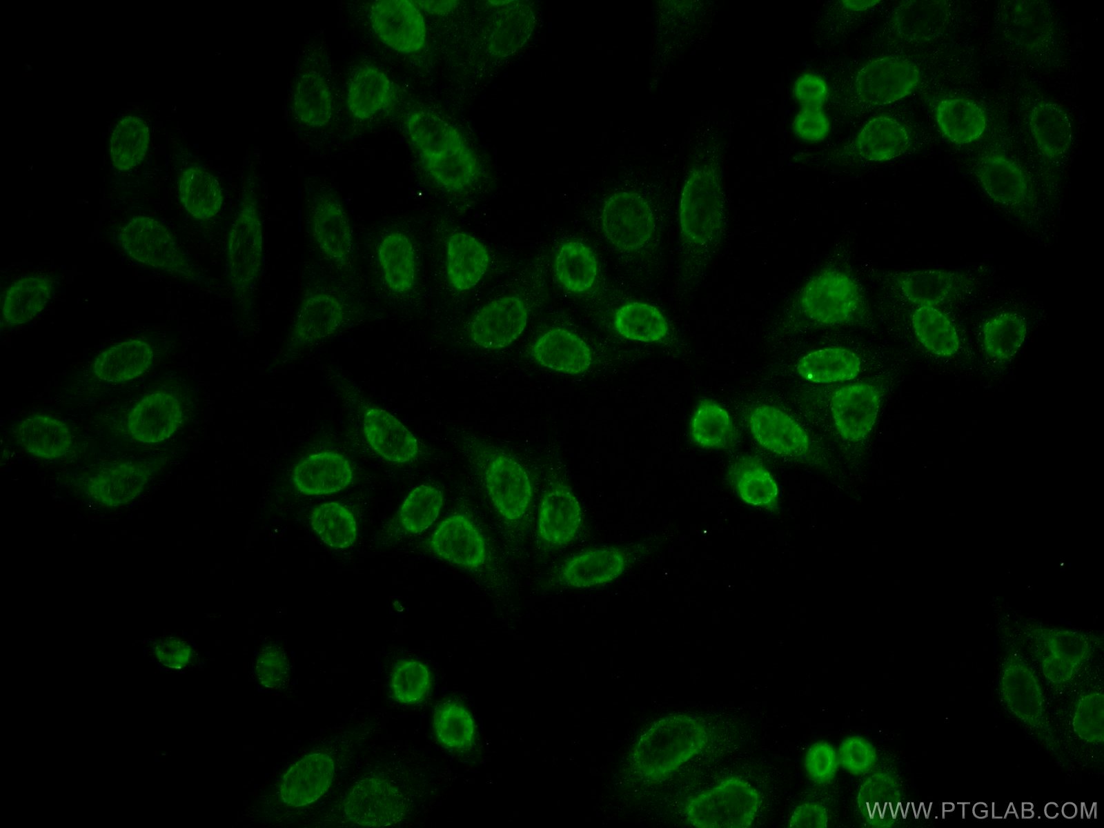 Immunofluorescence (IF) / fluorescent staining of HepG2 cells using MECP2 Polyclonal antibody (10861-1-AP)