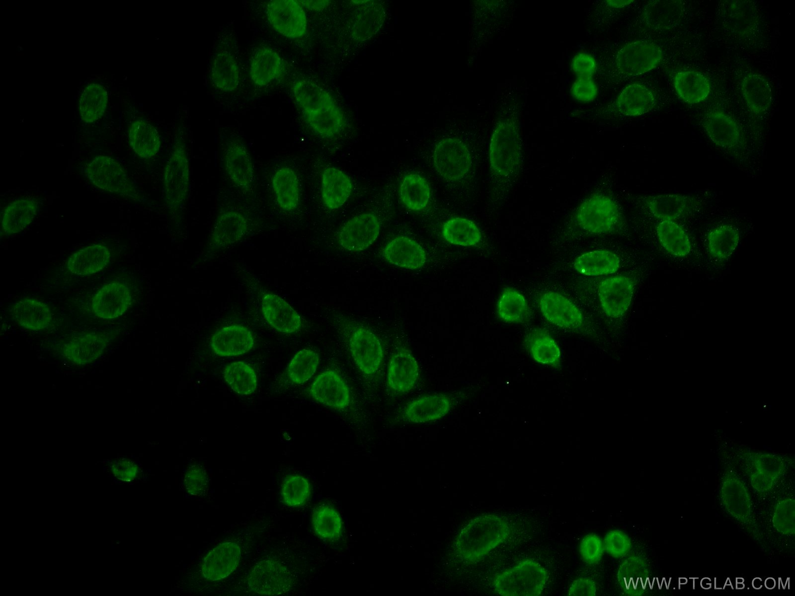 IF Staining of HepG2 using 10861-1-AP