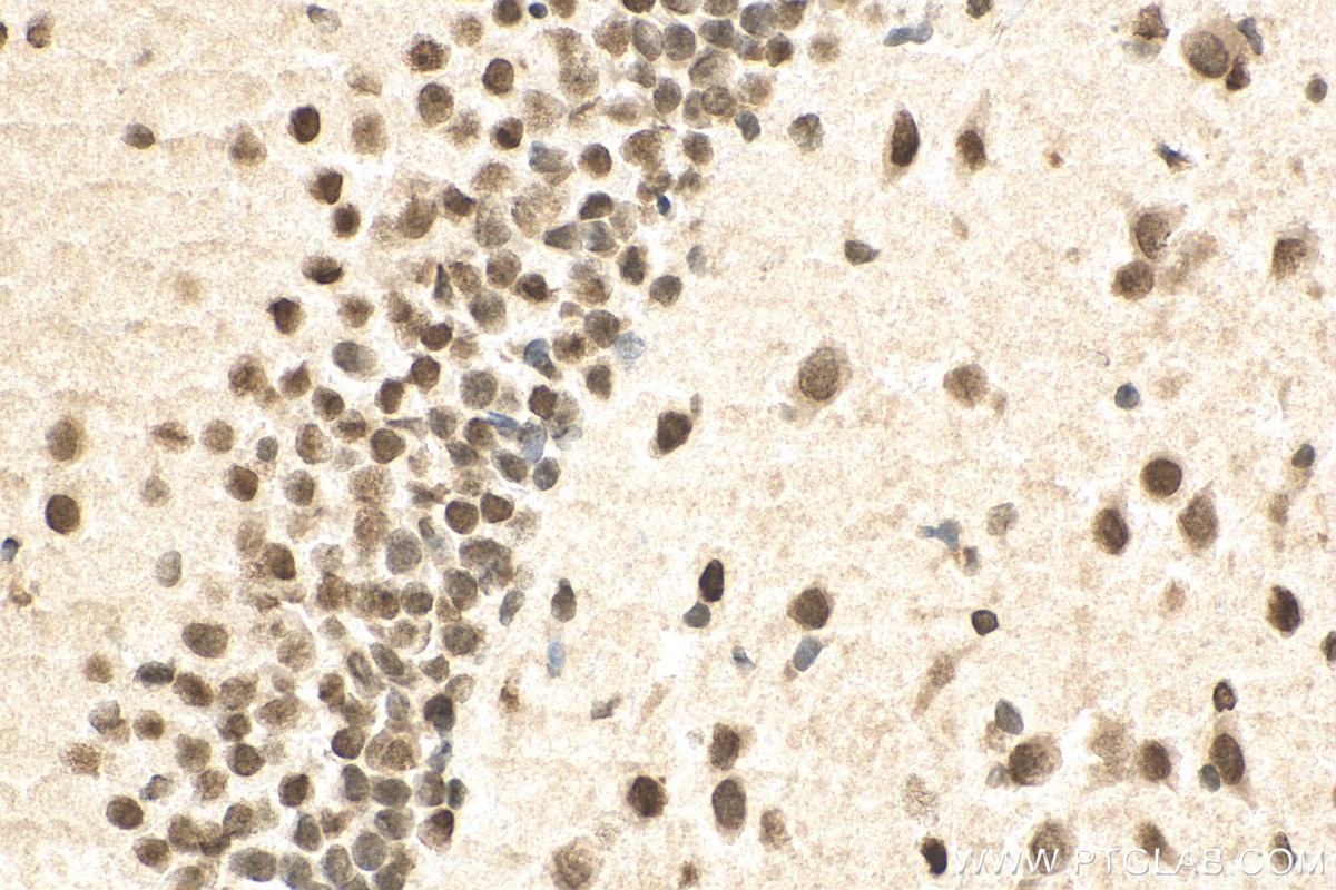Immunohistochemistry (IHC) staining of rat brain tissue using MECP2 Polyclonal antibody (10861-1-AP)