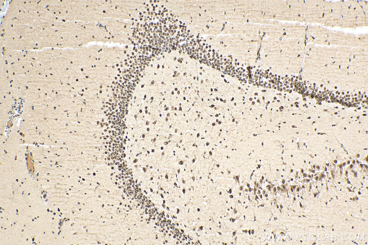 Immunohistochemistry (IHC) staining of rat brain tissue using MECP2 Polyclonal antibody (10861-1-AP)