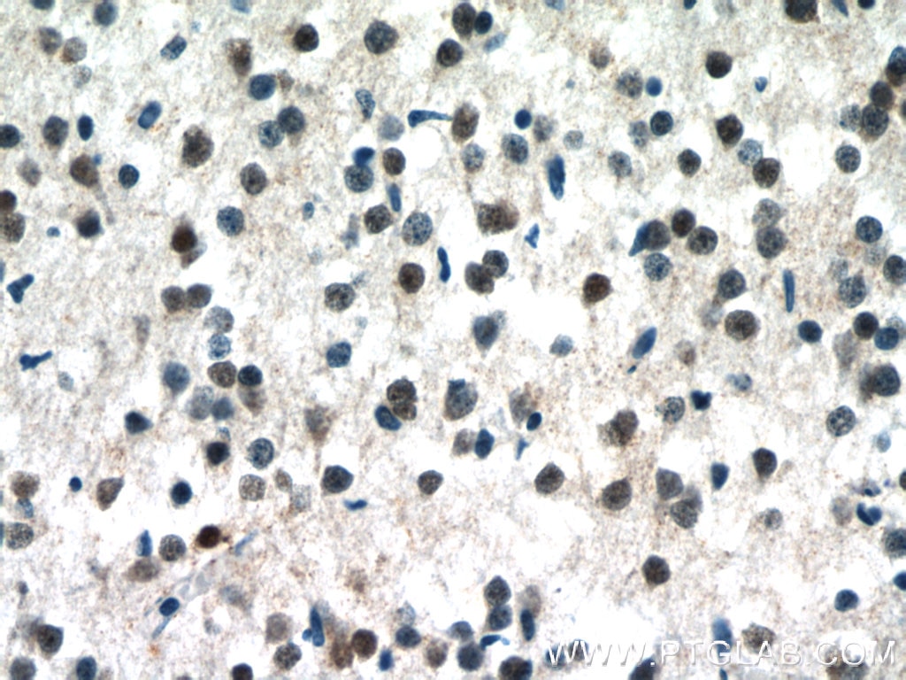 Immunohistochemistry (IHC) staining of human brain tissue using MECP2 Polyclonal antibody (10861-1-AP)