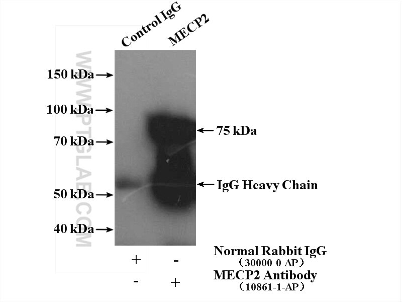 Immunoprecipitation (IP) experiment of MCF-7 cells using MECP2 Polyclonal antibody (10861-1-AP)