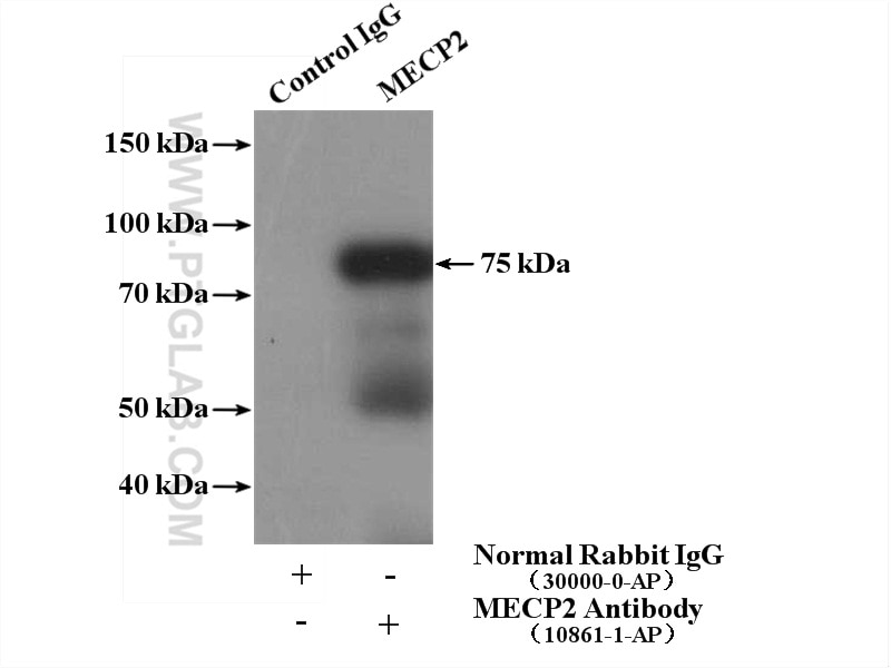 Immunoprecipitation (IP) experiment of MCF-7 cells using MECP2 Polyclonal antibody (10861-1-AP)