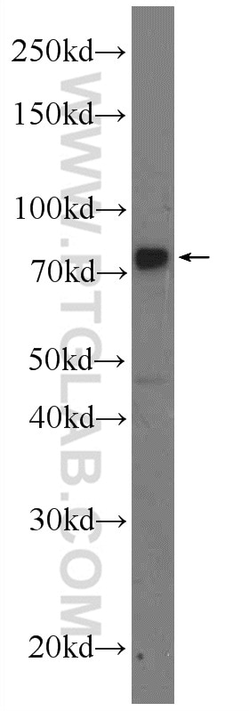 Western Blot (WB) analysis of MDA-MB-453s cells using MECP2 Polyclonal antibody (10861-1-AP)