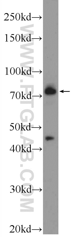 Western Blot (WB) analysis of SH-SY5Y cells using MECP2 Polyclonal antibody (10861-1-AP)