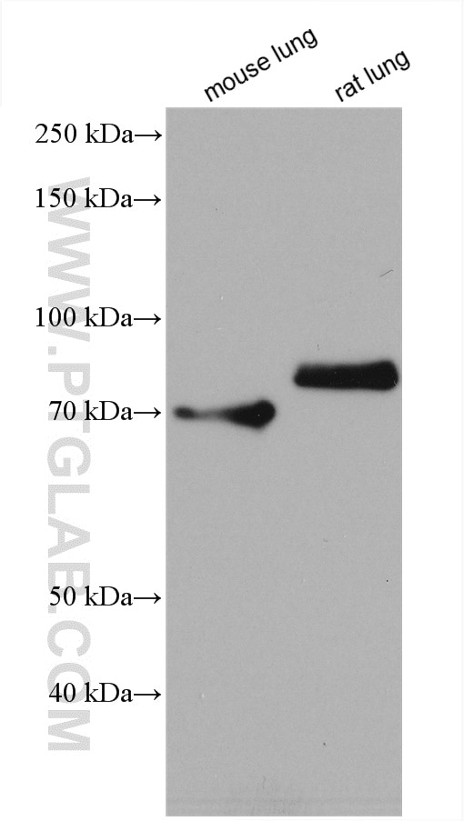 Western Blot (WB) analysis of various lysates using MECP2 Polyclonal antibody (10861-1-AP)