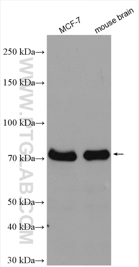 Western Blot (WB) analysis of various lysates using MECP2 Polyclonal antibody (10861-1-AP)