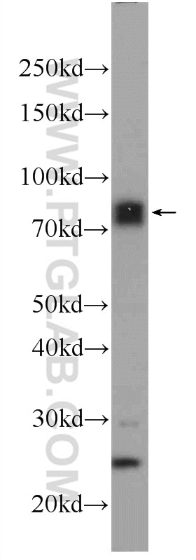 Western Blot (WB) analysis of mouse heart tissue using MECP2 Polyclonal antibody (10861-1-AP)