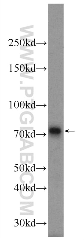 Western Blot (WB) analysis of mouse lung tissue using MECP2 Polyclonal antibody (10861-1-AP)