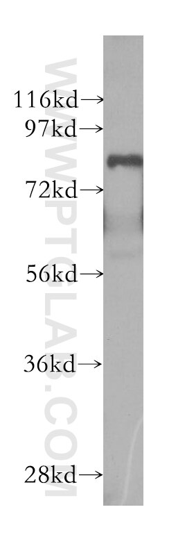 Western Blot (WB) analysis of human brain tissue using MECP2 Polyclonal antibody (10861-1-AP)