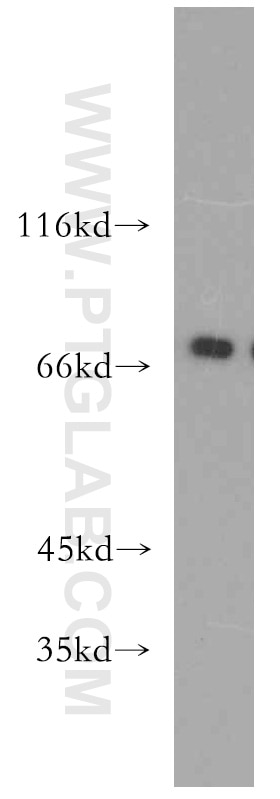 Western Blot (WB) analysis of mouse ovary tissue using MECP2 Polyclonal antibody (10861-1-AP)