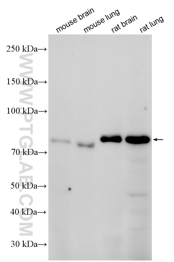 Western Blot (WB) analysis of various lysates using MECP2 Polyclonal antibody (33824-1-AP)