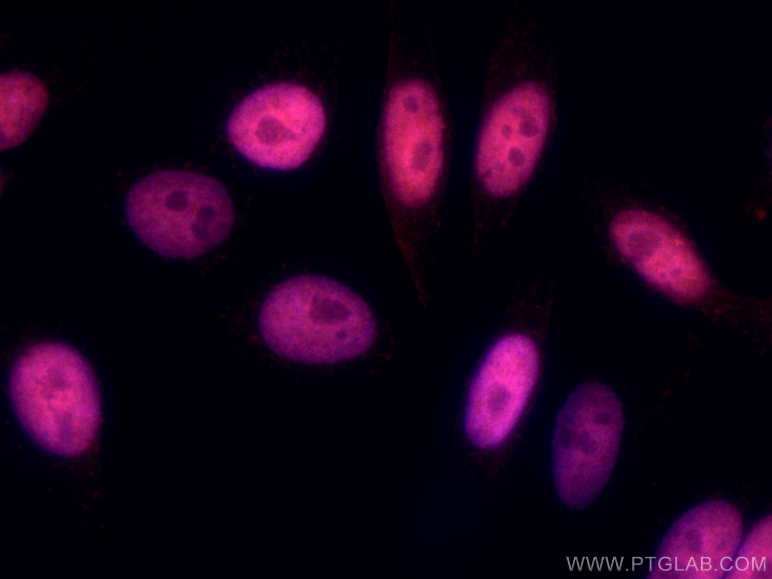 Immunofluorescence (IF) / fluorescent staining of HepG2 cells using CoraLite®555-conjugated MECP2 Polyclonal antibody (CL555-10861)