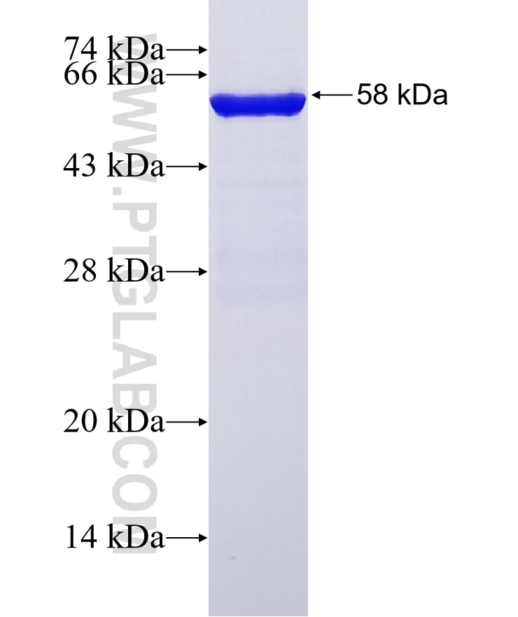 MECP2 fusion protein Ag29614 SDS-PAGE MECP2 fusion protein Ag29614 SDS-PAGE