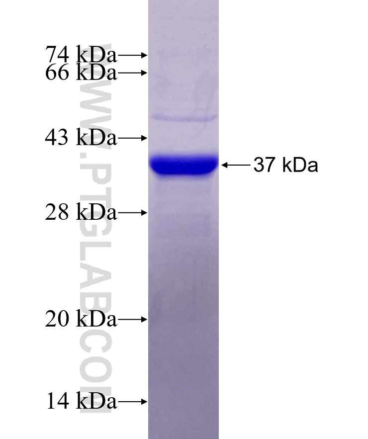 MECP2 fusion protein Ag29632 SDS-PAGE
